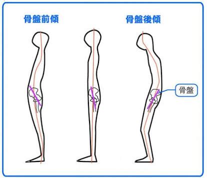 後面座位|「骨盤の前傾・後傾をつくる要因と、それにより起こ。